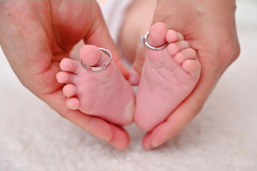 无锡孕妇怎样预防妊娠纹